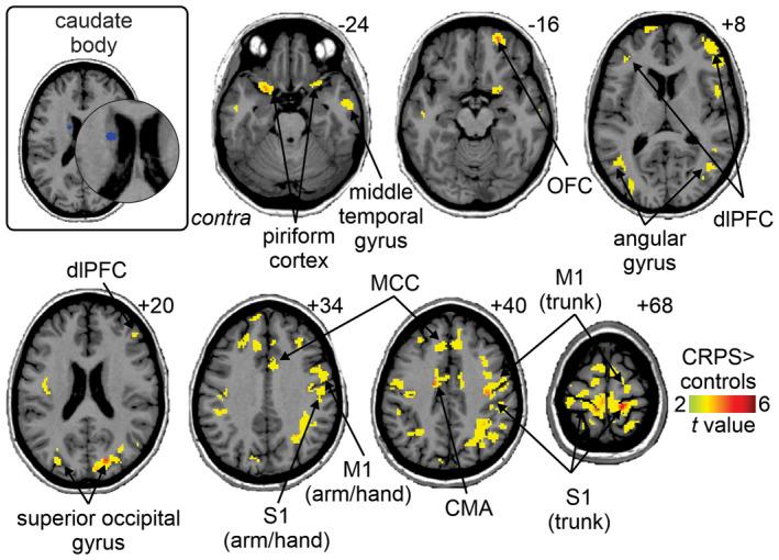 https://cdn.ncbi.nlm.nih.gov/pmc/blobs/2b70/9543905/d0ae817047fb/JNR-100-1487-g007.jpg
