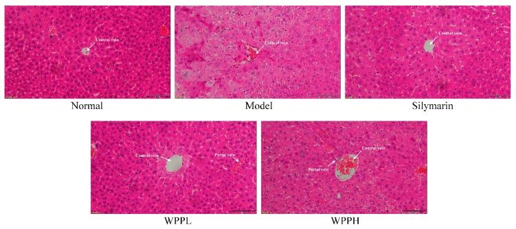 https://cdn.ncbi.nlm.nih.gov/pmc/blobs/2b73/6912415/3feb7e124df6/antioxidants-08-00524-g003.jpg