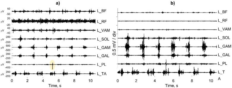 https://cdn.ncbi.nlm.nih.gov/pmc/blobs/2b74/9185290/e0202c67f2a8/sensors-22-04150-g027.jpg