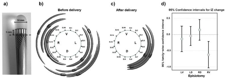 https://cdn.ncbi.nlm.nih.gov/pmc/blobs/2b74/9185290/e67834140b07/sensors-22-04150-g022.jpg