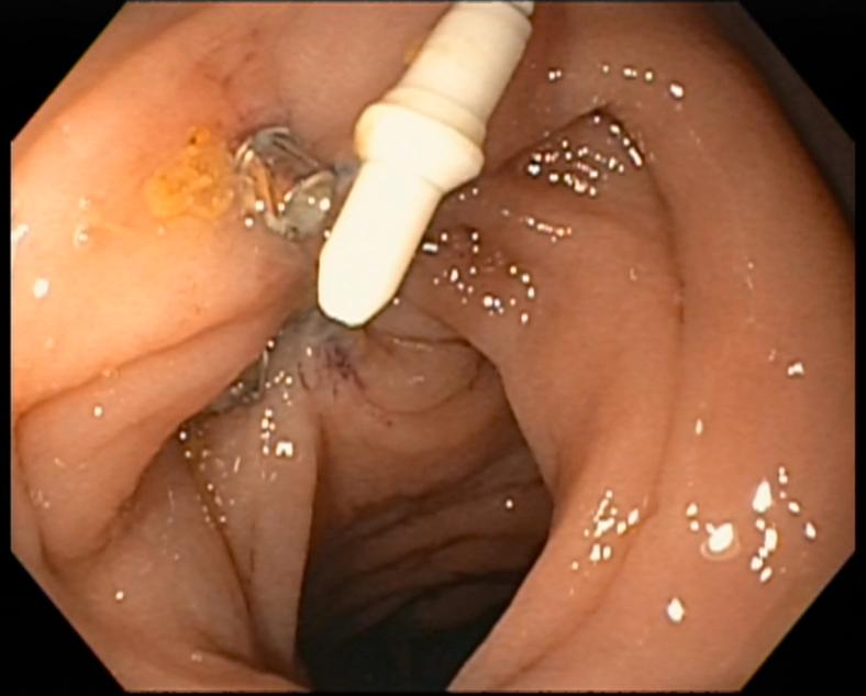 https://cdn.ncbi.nlm.nih.gov/pmc/blobs/2b77/9718656/d61a8b8e0997/gr4.jpg