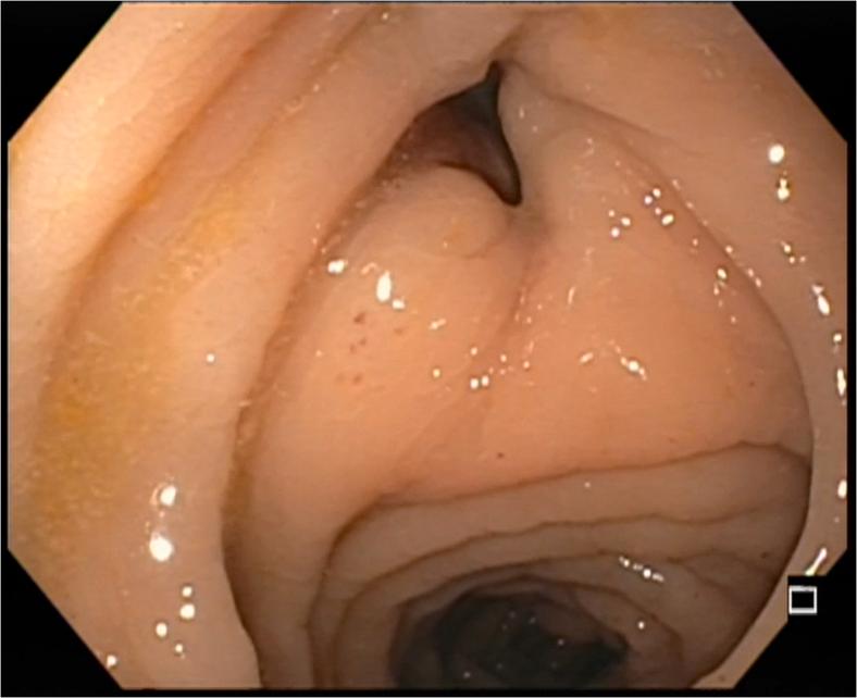 https://cdn.ncbi.nlm.nih.gov/pmc/blobs/2b77/9718656/fbd8677a5029/gr3.jpg