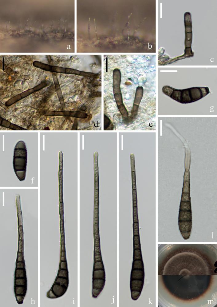 https://cdn.ncbi.nlm.nih.gov/pmc/blobs/2b7c/10862349/4a71e98510d6/mycokeys-102-001-g006.jpg