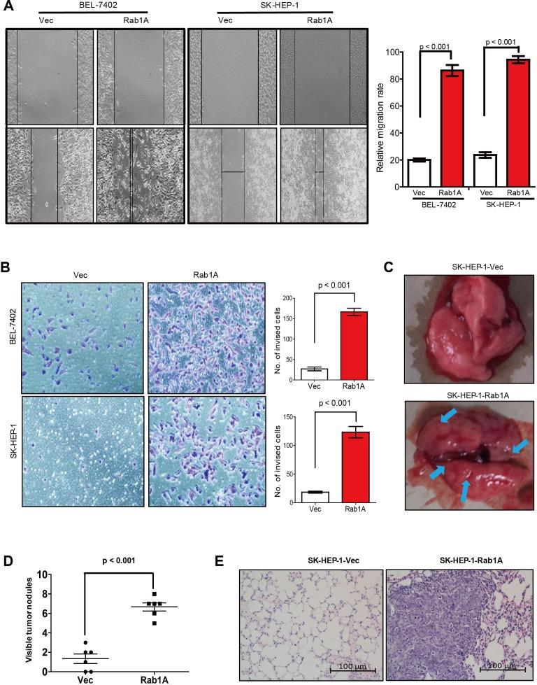 https://cdn.ncbi.nlm.nih.gov/pmc/blobs/2b7f/4673231/cdd6c5276e91/oncotarget-06-20813-g003.jpg