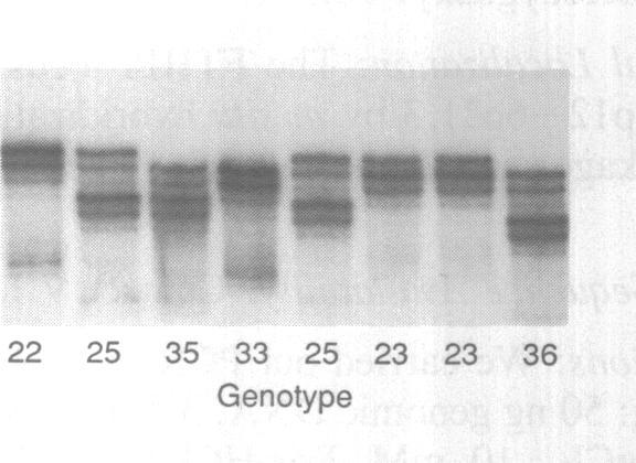 https://cdn.ncbi.nlm.nih.gov/pmc/blobs/2b80/329359/8fd44c1f09c5/nar00104-0280-a.jpg