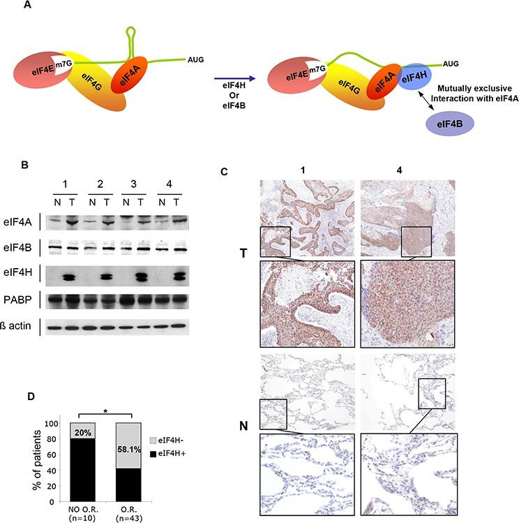 https://cdn.ncbi.nlm.nih.gov/pmc/blobs/2b82/4741870/30cc971380a9/oncotarget-06-39924-g001.jpg