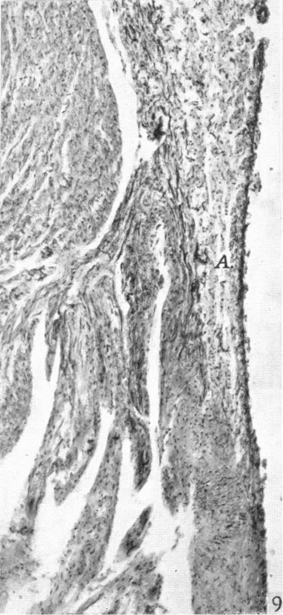 https://cdn.ncbi.nlm.nih.gov/pmc/blobs/2b84/1252470/2c75e6e9939e/janat00525-0159-d.jpg