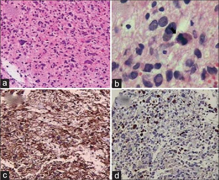 https://cdn.ncbi.nlm.nih.gov/pmc/blobs/2b8d/5409406/4b320918244a/AJNS-12-336-g002.jpg