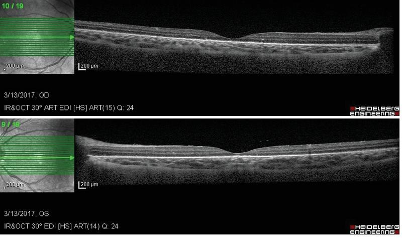 https://cdn.ncbi.nlm.nih.gov/pmc/blobs/2b93/7431713/e3cd56bce4c9/jovr-15-424-g004.jpg