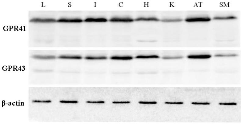 https://cdn.ncbi.nlm.nih.gov/pmc/blobs/2b97/4026140/5280c5666103/pone.0097342.g004.jpg