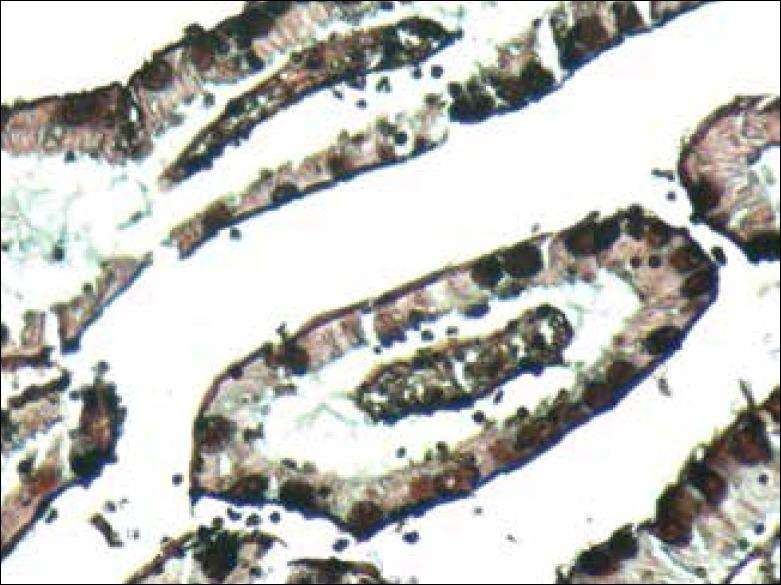 https://cdn.ncbi.nlm.nih.gov/pmc/blobs/2ba3/4660563/125bf59febb4/IJSTD-36-188-g004.jpg