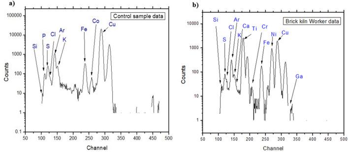 https://cdn.ncbi.nlm.nih.gov/pmc/blobs/2bab/9065070/3bb02b8bdaf9/41598_2022_11304_Fig2_HTML.jpg