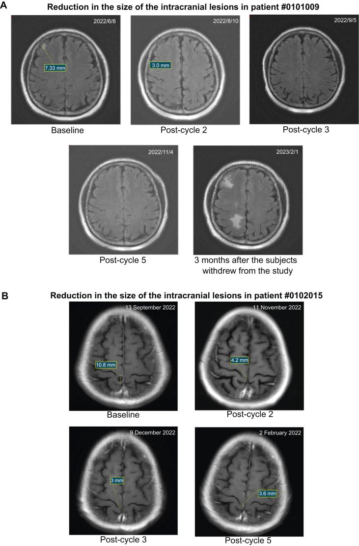 https://cdn.ncbi.nlm.nih.gov/pmc/blobs/2bb2/12141909/f5c22f502f53/gr2.jpg