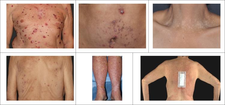 https://cdn.ncbi.nlm.nih.gov/pmc/blobs/2bb7/8237720/88d67bf522a0/jitc-2021-002435f01.jpg