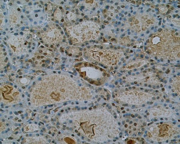https://cdn.ncbi.nlm.nih.gov/pmc/blobs/2bc2/2646698/5c26909ef2ae/1756-6614-2-1-3.jpg