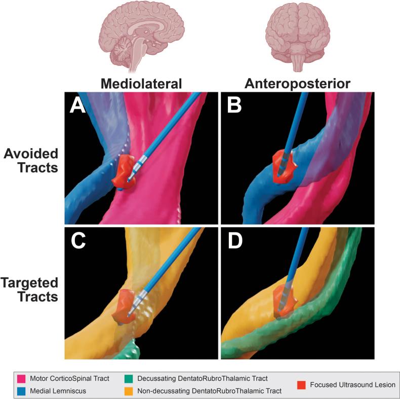 https://cdn.ncbi.nlm.nih.gov/pmc/blobs/2bce/12232443/1b13f7c19908/CASE25240_figure_3.jpg