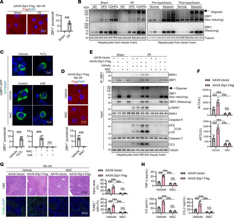 https://cdn.ncbi.nlm.nih.gov/pmc/blobs/2bd3/11213514/bcbedb206624/jci-134-180451-g065.jpg