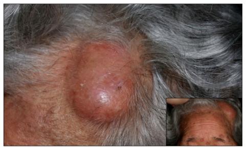 https://cdn.ncbi.nlm.nih.gov/pmc/blobs/2bd5/3229083/e0145f2727a0/ad-23-S267-g001.jpg