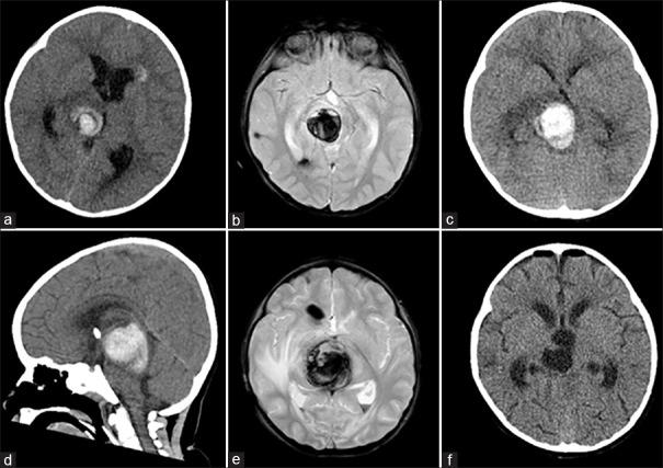 https://cdn.ncbi.nlm.nih.gov/pmc/blobs/2bdc/5299150/d6f919be3b24/SNI-7-1127-g001.jpg