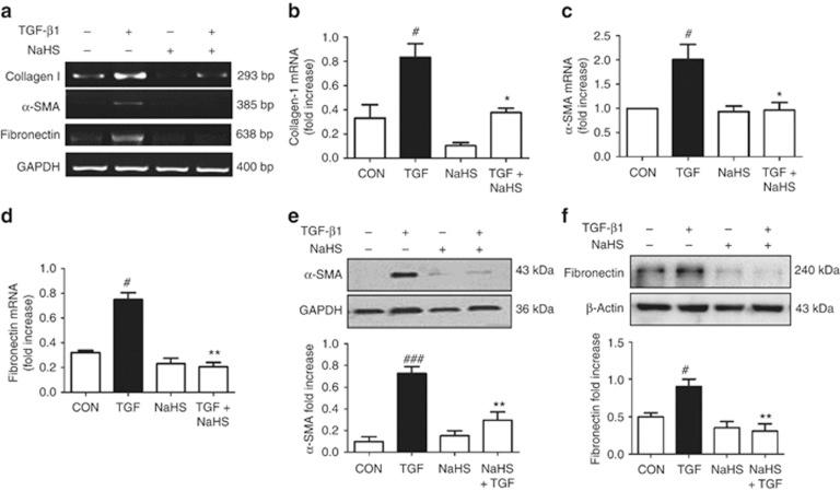 https://cdn.ncbi.nlm.nih.gov/pmc/blobs/2bdf/4040941/2f44ca152b96/ki2013449f9.jpg