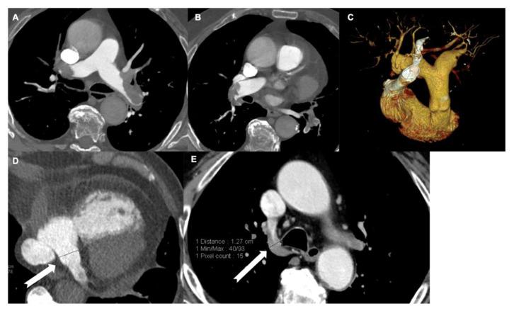 https://cdn.ncbi.nlm.nih.gov/pmc/blobs/2be6/8880178/3a68fc4017f9/tomography-08-00042-g003.jpg