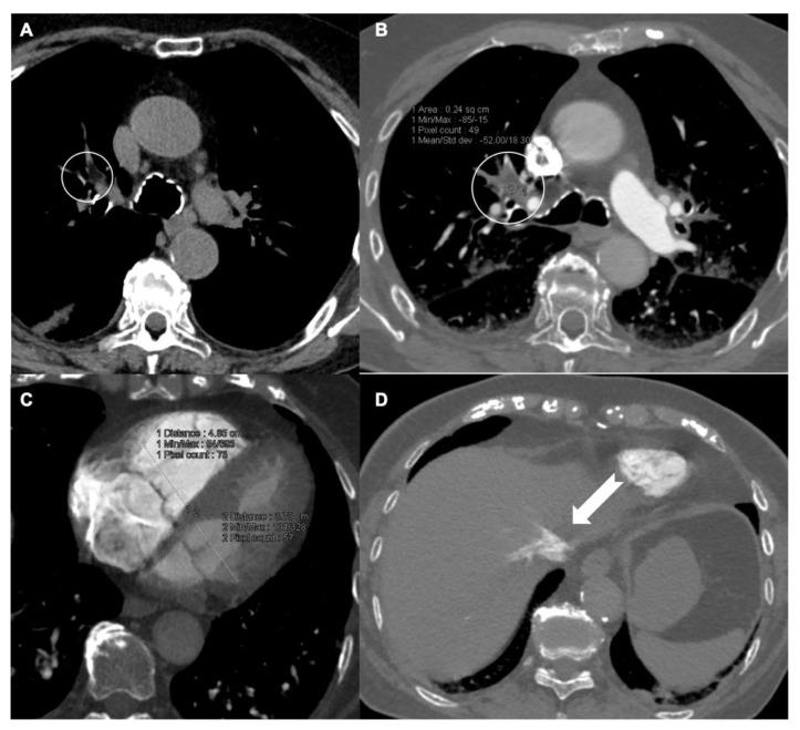 https://cdn.ncbi.nlm.nih.gov/pmc/blobs/2be6/8880178/e42e473fc08f/tomography-08-00042-g001.jpg