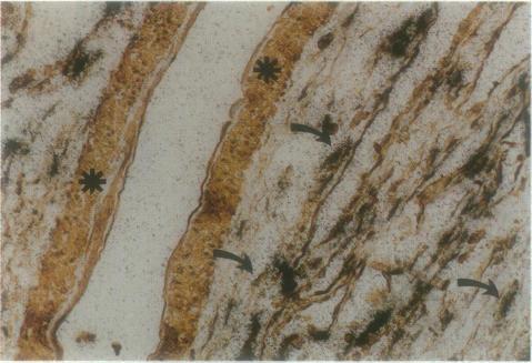 https://cdn.ncbi.nlm.nih.gov/pmc/blobs/2bed/1857832/dad14946cd1d/amjpathol00021-0020-a.jpg