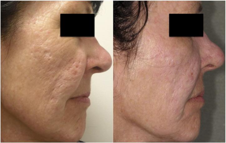 https://cdn.ncbi.nlm.nih.gov/pmc/blobs/2bf0/5418754/bc5d54e54431/gr1.jpg