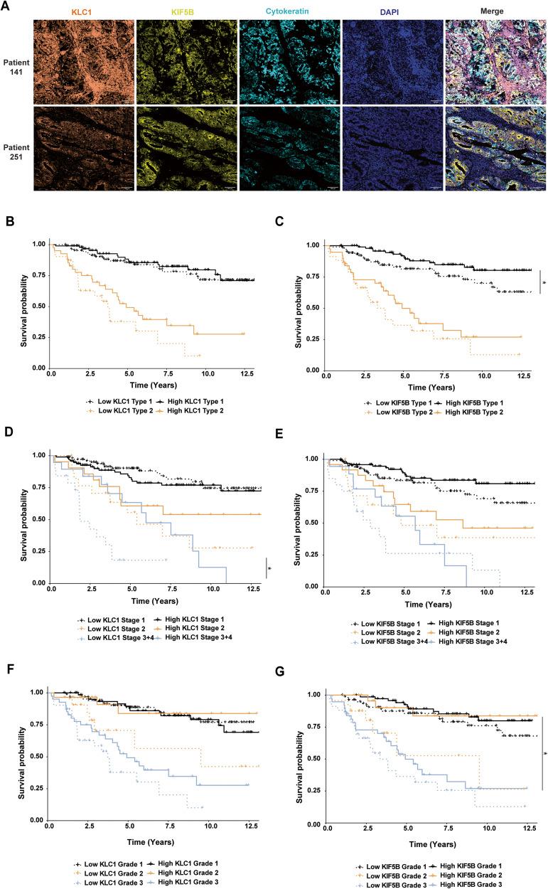 https://cdn.ncbi.nlm.nih.gov/pmc/blobs/2bf1/10997518/47c00d049477/41388_2024_2981_Fig6_HTML.jpg