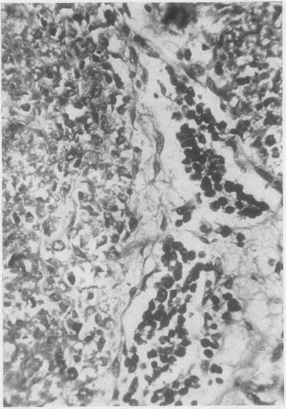 https://cdn.ncbi.nlm.nih.gov/pmc/blobs/2bf1/472833/005b6877d6d4/jclinpath00354-0066-a.jpg