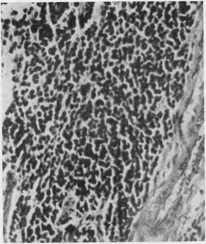 https://cdn.ncbi.nlm.nih.gov/pmc/blobs/2bf1/472833/2f6b219a84b1/jclinpath00354-0065-a.jpg
