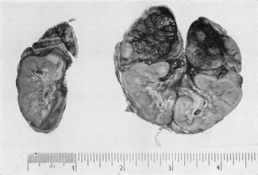 https://cdn.ncbi.nlm.nih.gov/pmc/blobs/2bf1/472833/b407ff629017/jclinpath00354-0061-a.jpg