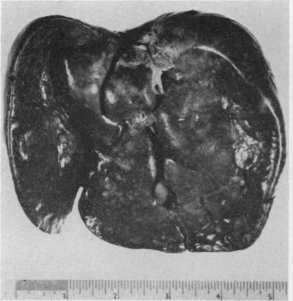 https://cdn.ncbi.nlm.nih.gov/pmc/blobs/2bf1/472833/c9e81a491ee1/jclinpath00354-0061-c.jpg