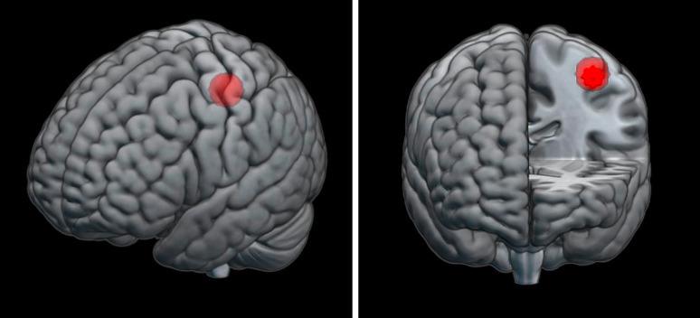 https://cdn.ncbi.nlm.nih.gov/pmc/blobs/2bf8/10871686/f4e6e3b85218/nps-2024-0083-0001-535512_F01.jpg