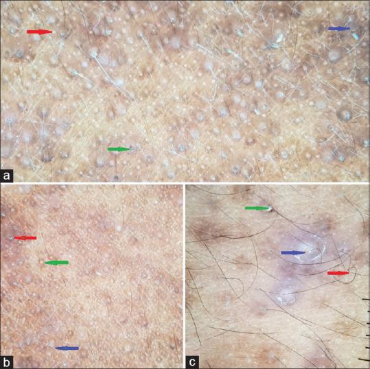 https://cdn.ncbi.nlm.nih.gov/pmc/blobs/2bfa/7678525/60f84dc2fbe3/IDOJ-11-818-g004.jpg