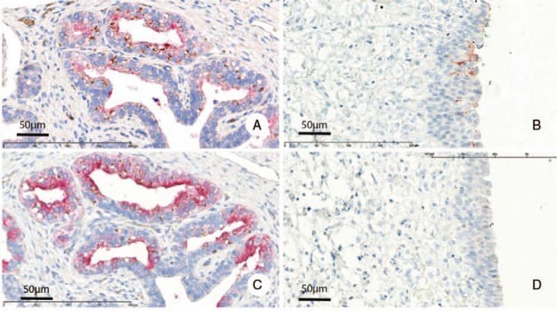 https://cdn.ncbi.nlm.nih.gov/pmc/blobs/2bfd/5627816/d6a20aa8c3d0/medi-96-e7489-g003.jpg