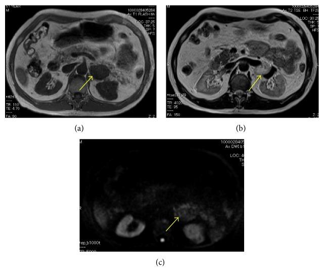 https://cdn.ncbi.nlm.nih.gov/pmc/blobs/2bff/5836307/6755d7927286/CRIM2018-8796327.001.jpg
