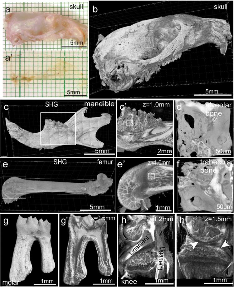 https://cdn.ncbi.nlm.nih.gov/pmc/blobs/2bff/6082844/fa0ee7312722/41422_2018_49_Fig4_HTML.jpg