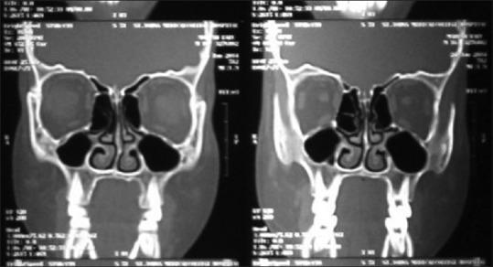 https://cdn.ncbi.nlm.nih.gov/pmc/blobs/2c04/4847470/55b32c4b883b/JISP-20-203-g002.jpg