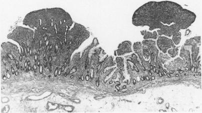 https://cdn.ncbi.nlm.nih.gov/pmc/blobs/2c05/1382950/57ee9c9e6a34/gut00531-0118-a.jpg