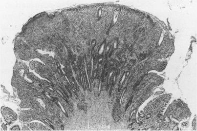 https://cdn.ncbi.nlm.nih.gov/pmc/blobs/2c05/1382950/d6cc713bd0a4/gut00531-0119-a.jpg