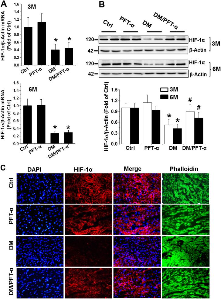 https://cdn.ncbi.nlm.nih.gov/pmc/blobs/2c0b/5833384/d5c439a02eca/41419_2017_93_Fig6a_HTML.jpg
