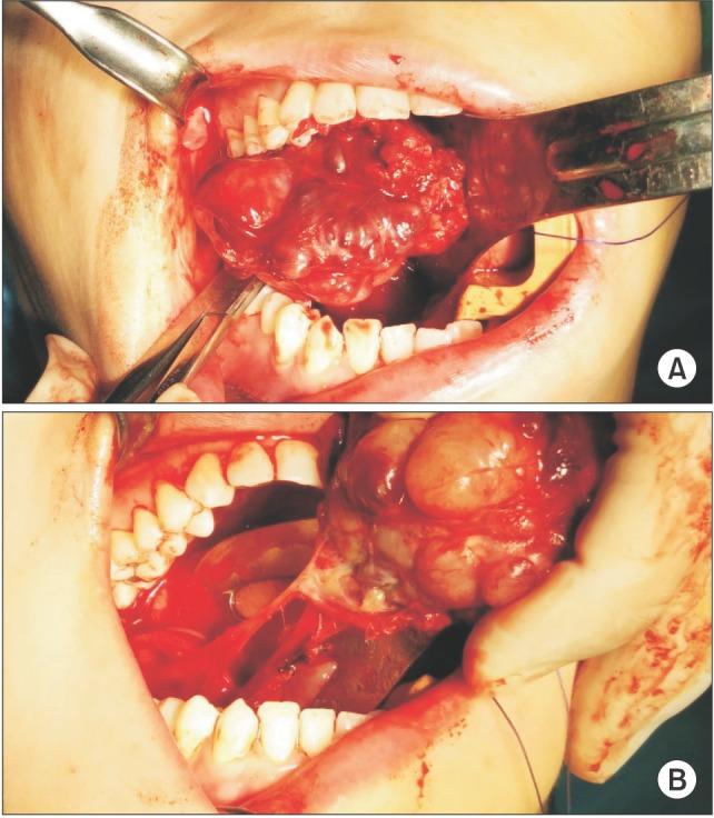https://cdn.ncbi.nlm.nih.gov/pmc/blobs/2c10/4761576/c850410fd7db/jkaoms-42-60-g005.jpg