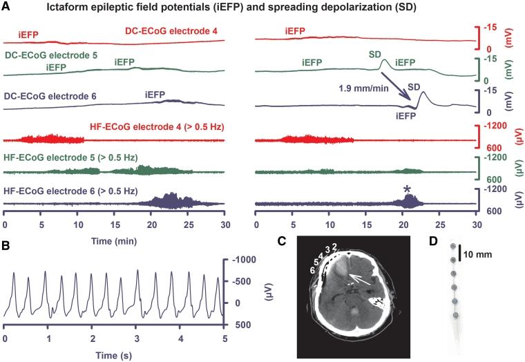 https://cdn.ncbi.nlm.nih.gov/pmc/blobs/2c11/3267981/932bfcc1bac4/awr303f3.jpg