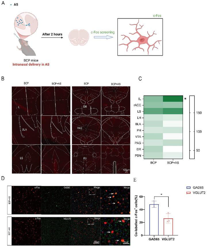https://cdn.ncbi.nlm.nih.gov/pmc/blobs/2c12/12086296/8cdf69dd52dc/BRB3-15-e70555-g004.jpg