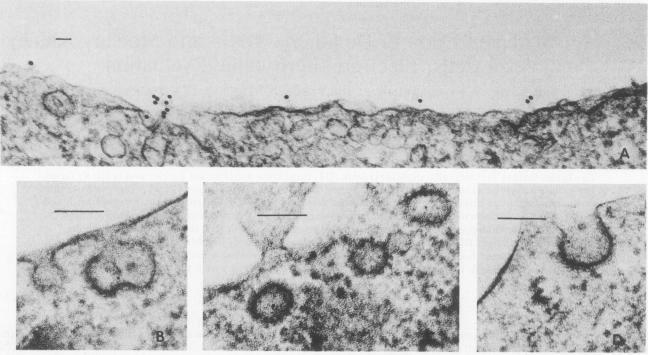 https://cdn.ncbi.nlm.nih.gov/pmc/blobs/2c17/261139/474d8f17d3a6/iai00111-0130-a.jpg