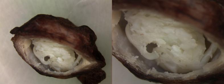 https://cdn.ncbi.nlm.nih.gov/pmc/blobs/2c1a/7582219/0f2875c56540/gr2.jpg