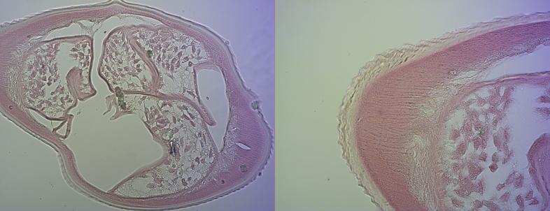 https://cdn.ncbi.nlm.nih.gov/pmc/blobs/2c1a/7582219/d85b355563fa/gr1.jpg