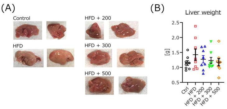 https://cdn.ncbi.nlm.nih.gov/pmc/blobs/2c1b/9101427/904058b52edb/nutrients-14-01794-g006.jpg