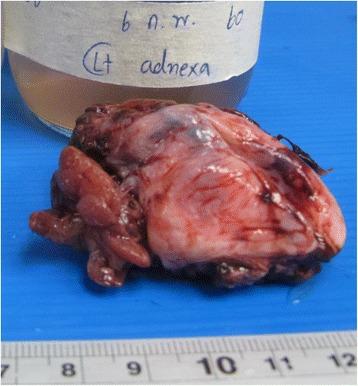https://cdn.ncbi.nlm.nih.gov/pmc/blobs/2c1c/5806353/627bc102514d/12879_2018_2986_Fig3_HTML.jpg